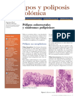 Pólipos colorrectales: clasificación, características y síndromes polipósicos