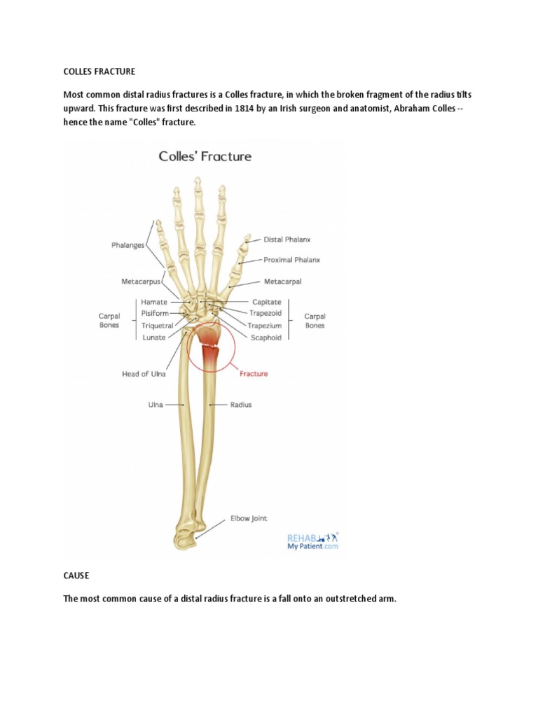Colles Fracture | PDF