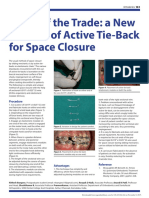 Tricks of The Trade: A New Method of Active Tie-Back For Space Closure