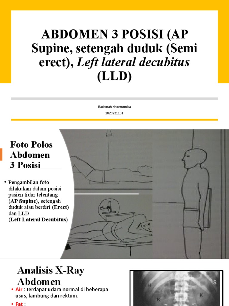 Referat Abdomen 3 Posisi - Rachmah Khoerunnisa - 1820221151 | PDF