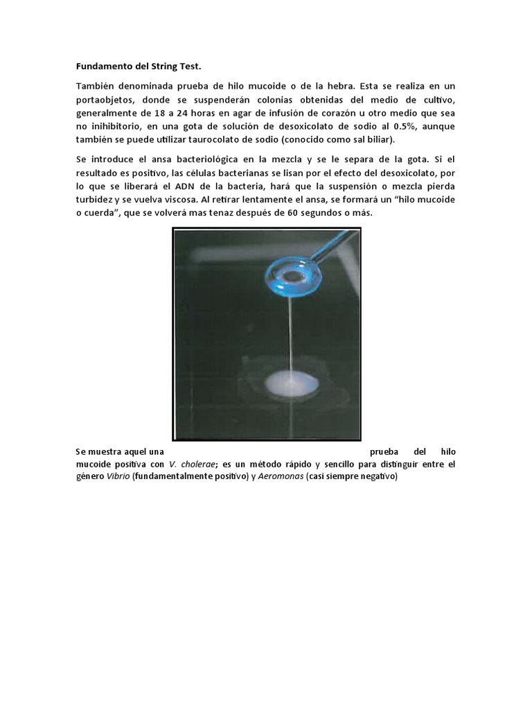 Fundamento del String Test en Vibrio | PDF