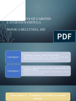 Case Report of Carotid Cavernous Fistula. ONI