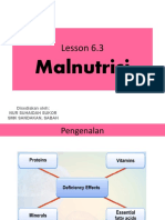 Malnutrisi