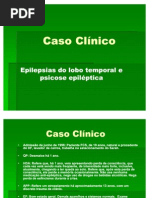 Caso Clínico epilepsia do lobo temporal modelo sarah