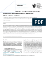 Buccal Infiltration in MN Molars PDF