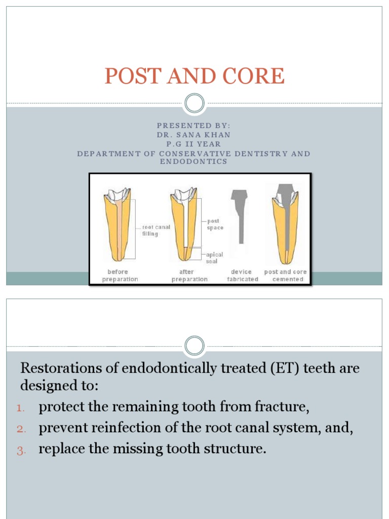 Post and Core in Endodontics | PDF | Periodontology | Zirconium Dioxide