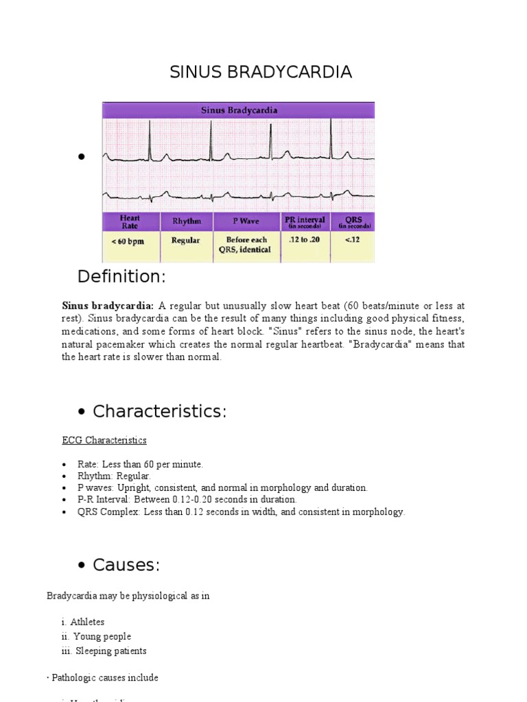 SINUS BRADYCARDIA Artificial Cardiac Pacemaker Cardiovascular