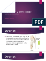 Overbite y Overjet