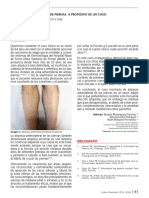 Alopecia Anterolateral de Piernas PDF