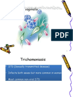 Trichomonas Vaginalis