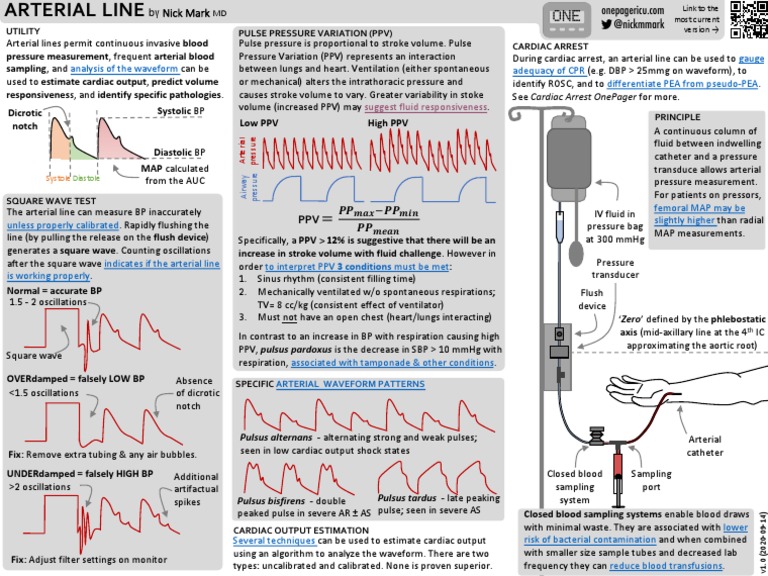 Suggest Fluid Responsiveness Pulse Pressure Variation (PPV) Cardiac
