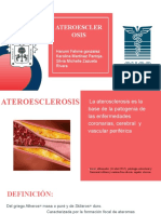 Ateroesclerosis 2.