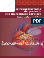 El electrocardiograma del paciente con marcapasos cardiaco.pdf