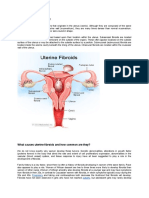 What are uterine fibroids? Causes, symptoms, diagnosis and treatment