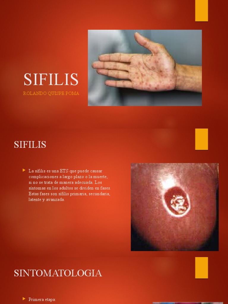 Sifilis Rolando | PDF | Infección transmitida sexualmente | Inmunología