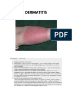 Dermatitis X Contacto