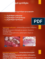 Parodontiti