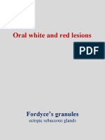 Oral White and Red Lesions