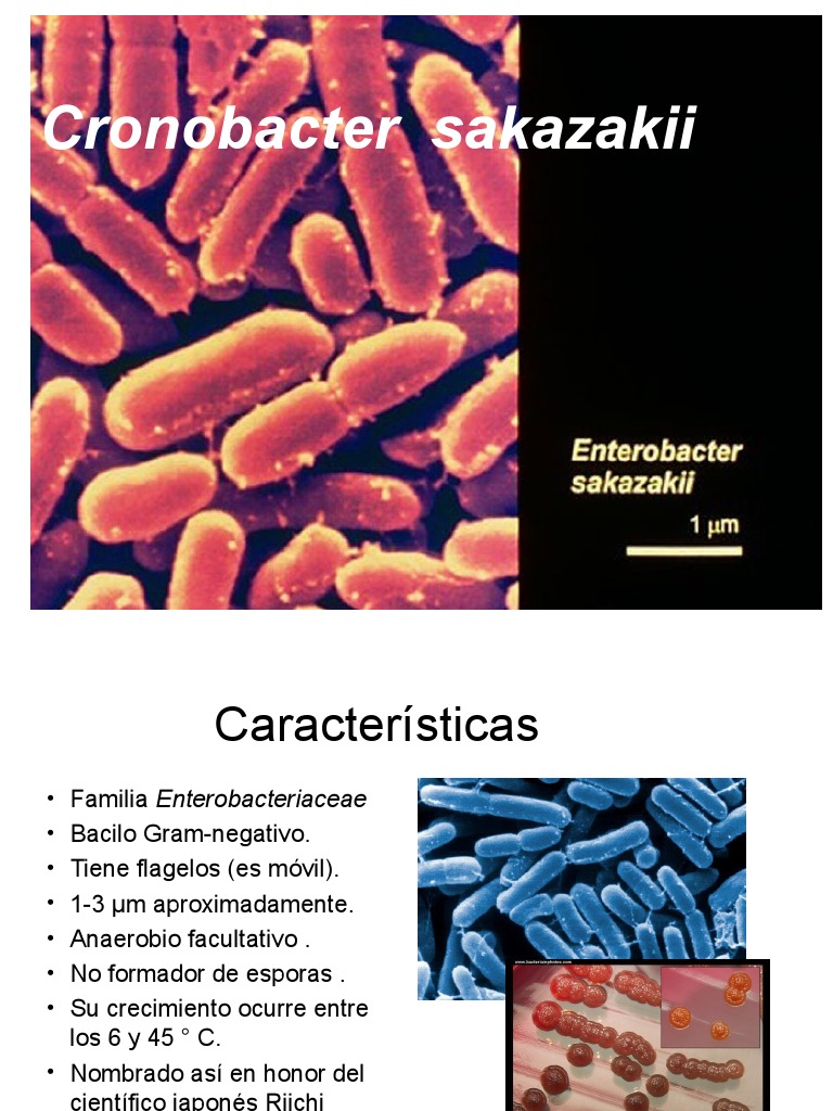 Características de Cronobacter sakazakii | PDF | Cocina, comidas y vino ...