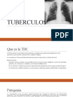 Tuberculosis