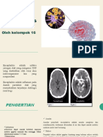 ENSEFALITIS Tiara Dan Agstri