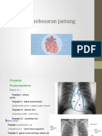 Pembesaran Jantung