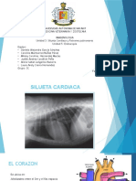 Silueta Cardiaca