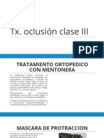 TX Oclusión Clase III