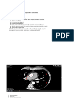 Reconocimiento de estructuras cardiacas en imágenes axiales