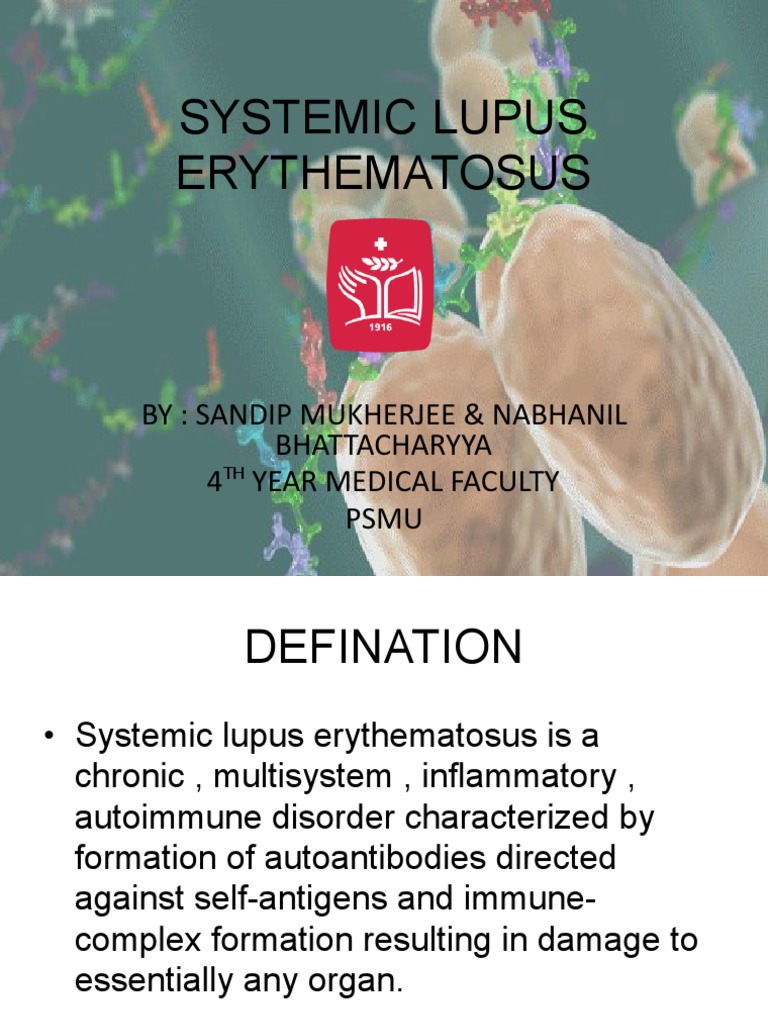 Systemic Lupus Erythematosus PDF