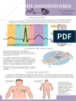 Electrocardiograma: Definición