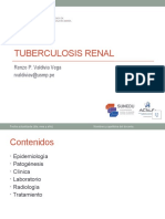 S44 - Teo TBC Renal