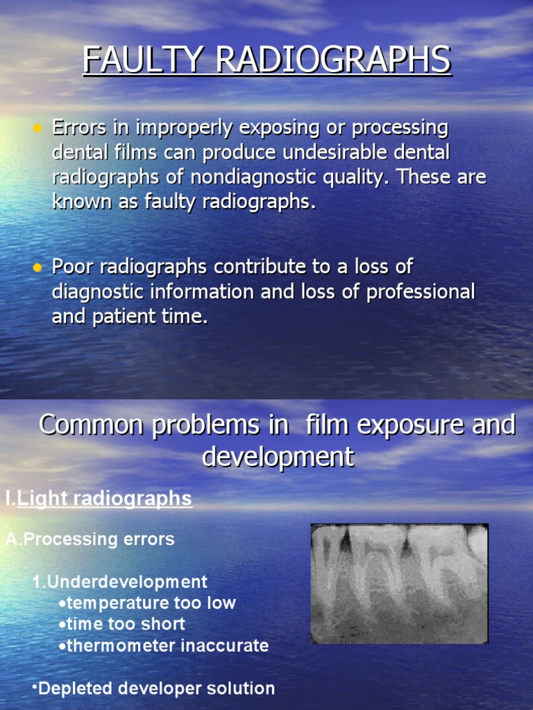 Faulty Radiographs | PDF