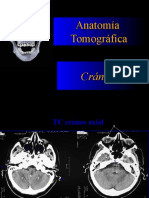 Anatomia Por Tomografia