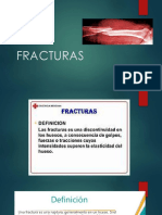 Frac Turas