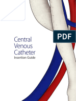 Central Venous Catheter: Insertion Guide