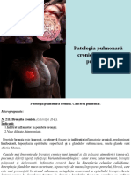 Patologia Pulmonară Cronică. Cancerul Pulmonar.