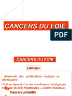 Cancers Du Foie