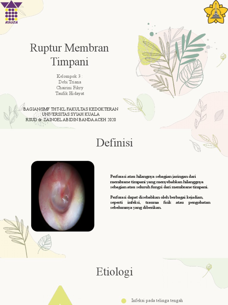 Ruptur Membran Timpani PDF