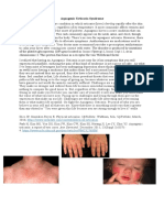 Aquagenic Urticaria Syndrome 24