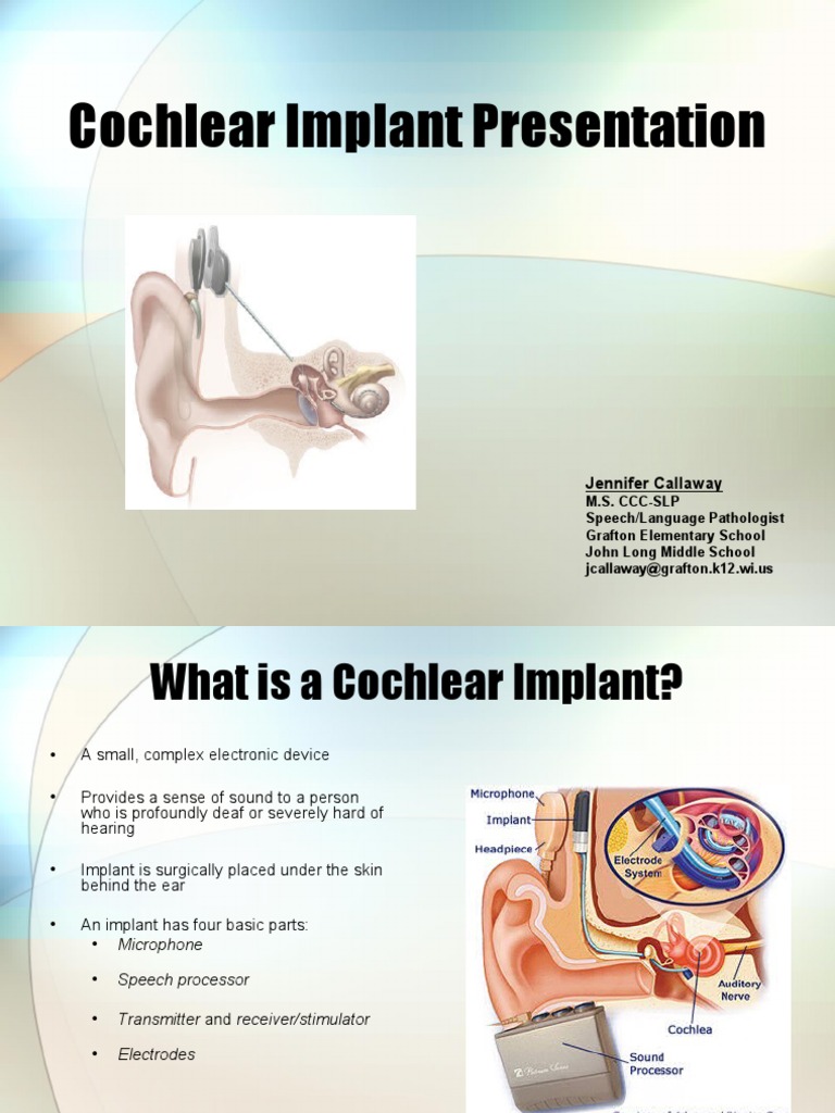 Cochlear Implant Presentation: Jennifer Callaway | PDF | Ear | Hearing Aid