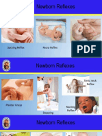 Newborn Reflexes: Sucking Reflex Palmar Grasp Moro Reflex