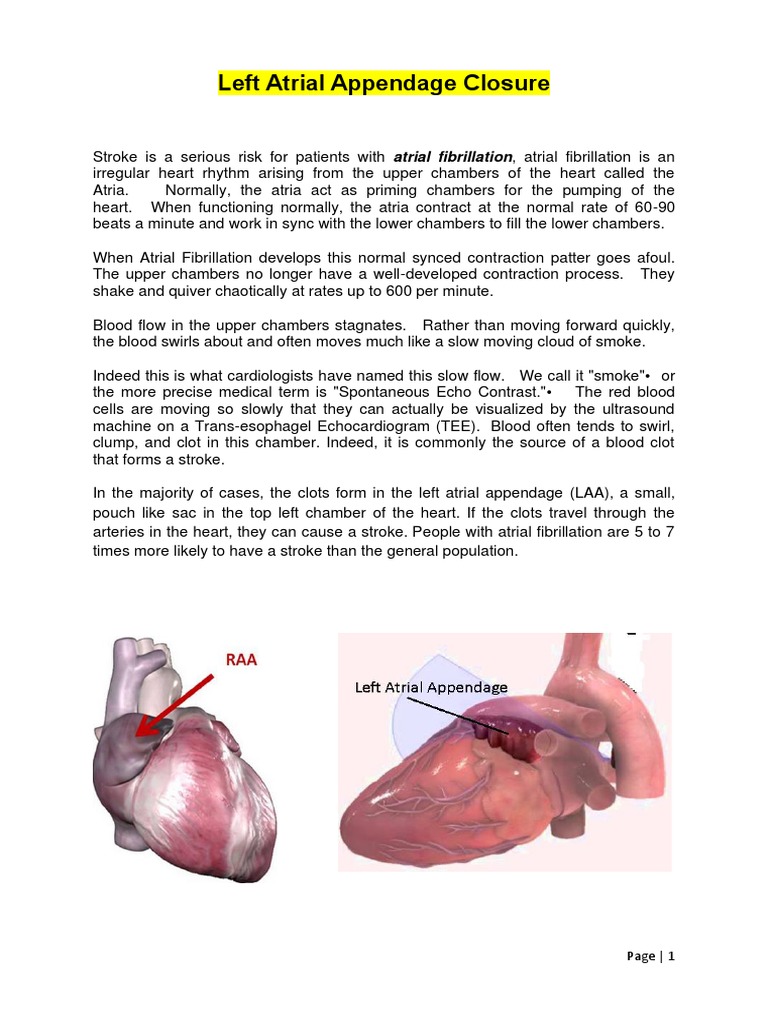 Left Atrial Appendage Closure Options | PDF | Cardiovascular Diseases ...