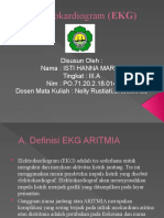 Elektrokardiogram (EKG) ARITMIA (Kelompok 1) - ISTI HANNA MARYA - PO7120218014 - TK3A