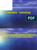 Cancerul Tiroidian