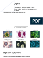 Tonsillopharyngitis