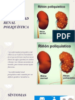 Enfermedad Renal Poliquística