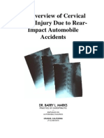 Facet Joint Injuries From Car Accidents