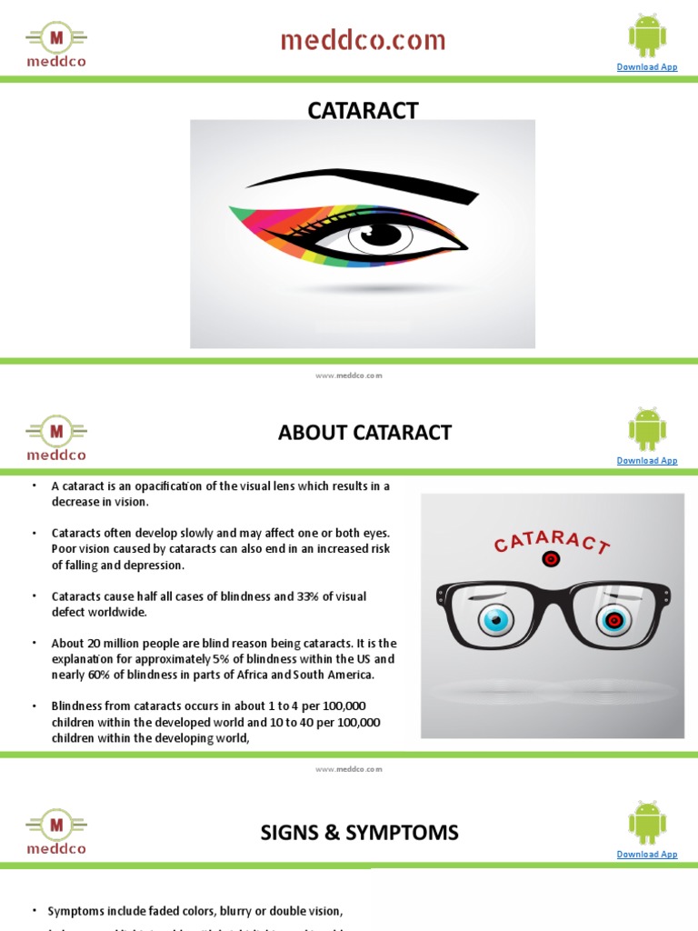 Cataract Pdf