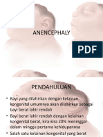 Anensefali 3